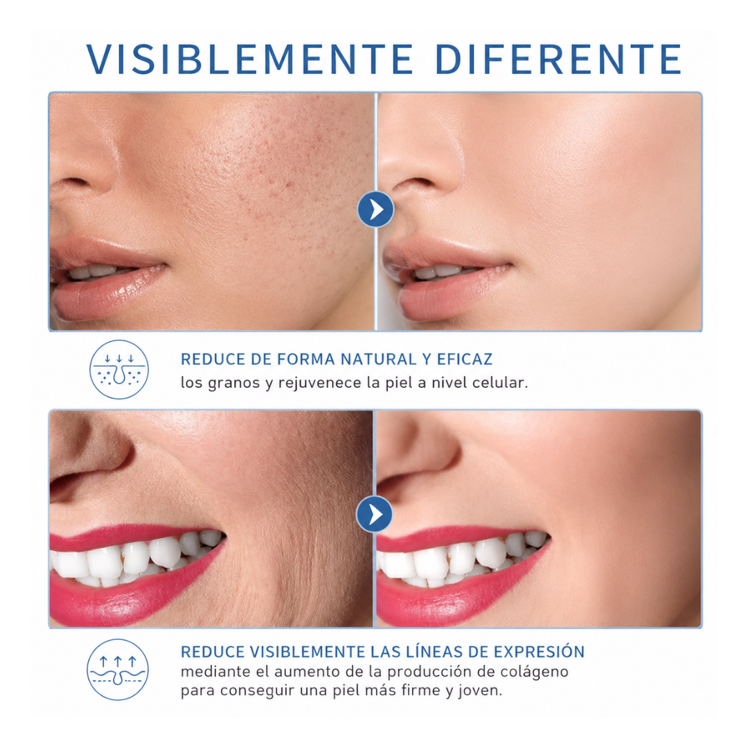 Tu rutina facial profesional ahora desde casa con Alta Frecuencia Facial y Capilar