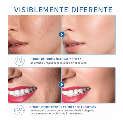 Tu rutina facial profesional ahora desde casa con Alta Frecuencia Facial y Capilar
